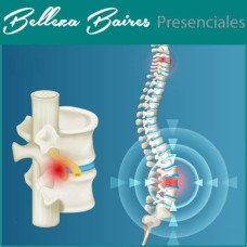 Taller Presencial de Hernia de Disco