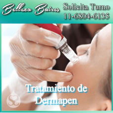 Tratamiento con Dermapen