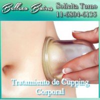 Tratamiento de Cupping Corporal