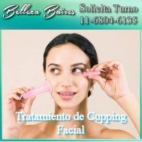 Tratamiento de Cupping Facial